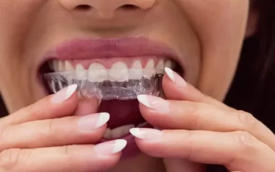 Invisalign Kansas City: Clear Aligner Therapy for Discreet Orthodontic Correction